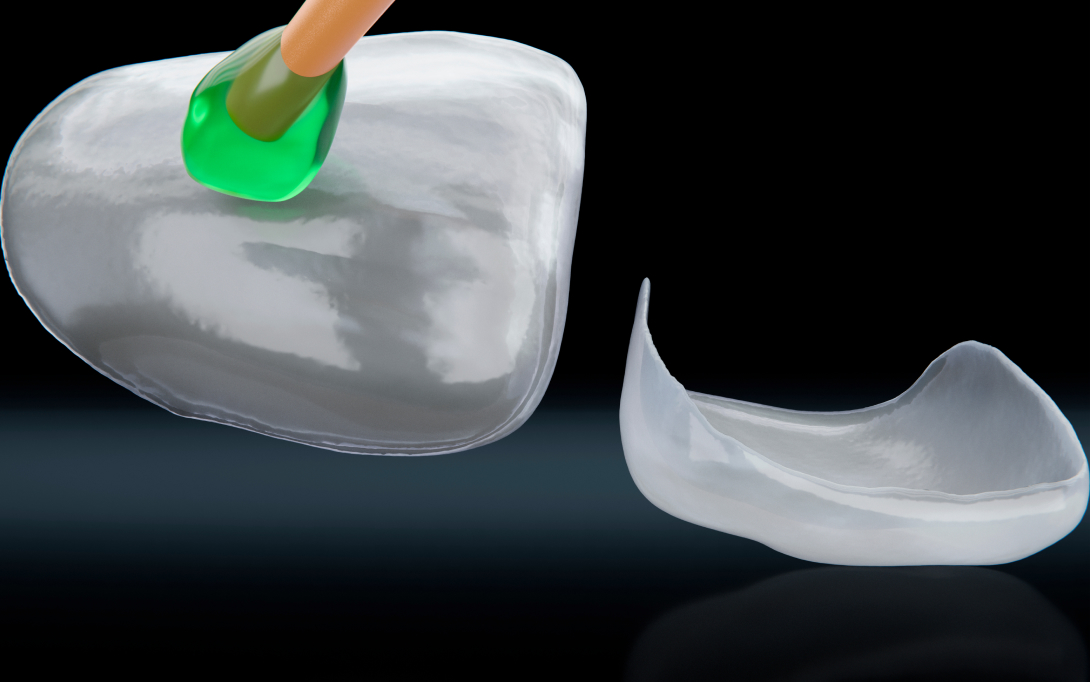 veneers 3d render